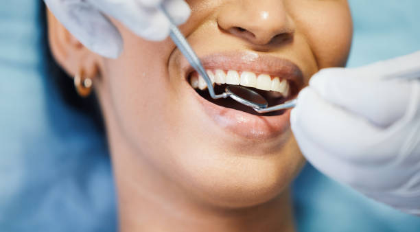 Best Chipped Tooth Repair Near Me  in Surrey, ND