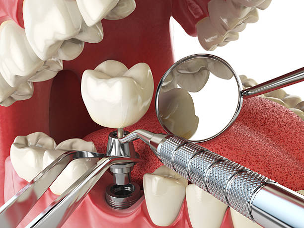 Best Tooth Infection Emergency Dentist  in Surrey, ND