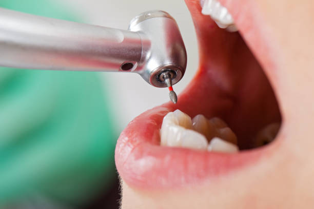 Best Dentist Open on Weekends  in Surrey, ND